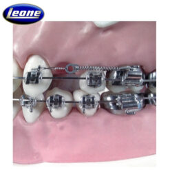 Resortes Cerrados MEMORIA con terminales y alambre para ligaduras Leone