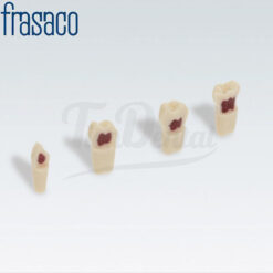 Dientes Pulpotomía Frasaco AK-6/2 ZPUW