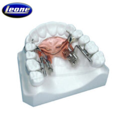 Distalizador Fast Back Leone 1 Caso