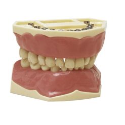 Tipodonto Frasaco AK6/2 Modelo Infantil