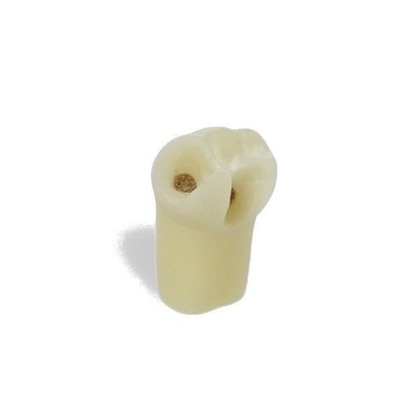 Diente con caries simulada Frasaco AG3ZSDK.300V1 Número 46