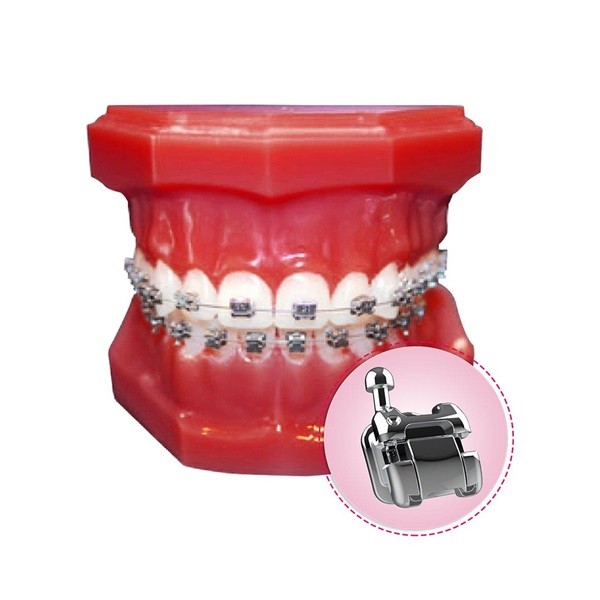 Tipodonto de demostración con Brackets Autoligados PLUS