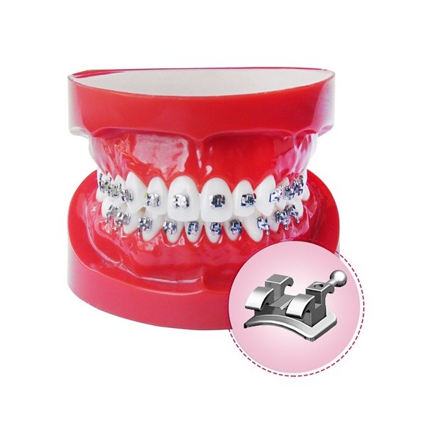 Tipodonto de demostración con Brackets Metálicos