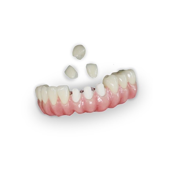 Bonding Circonio Composite