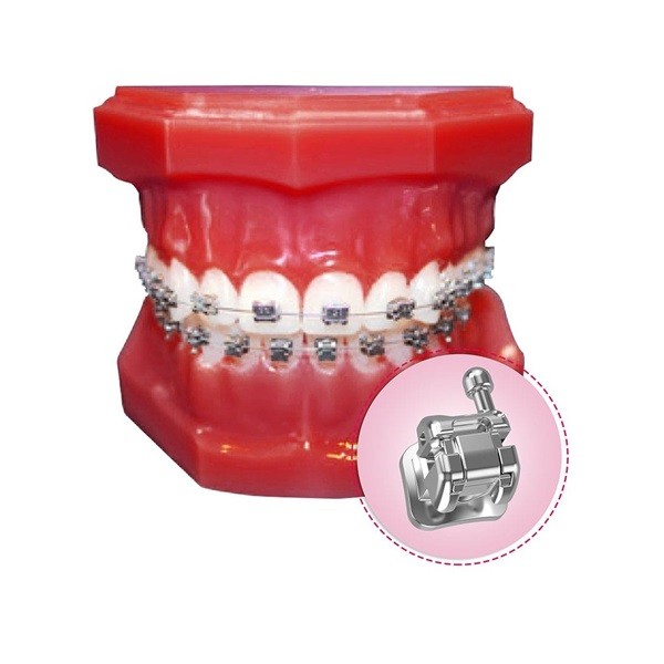 Tipodonto de demostración con Brackets Autoligados