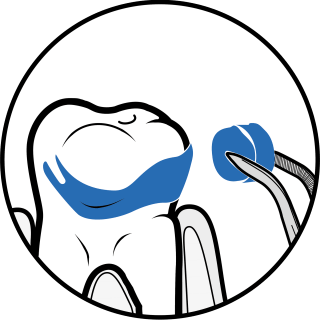 GUIDED BIOFILM THERAPY