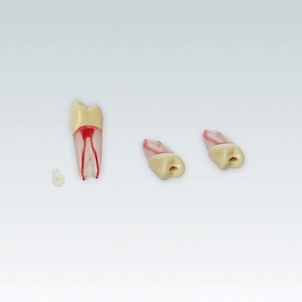 ANA4ZPUKN24 Diente endodoncia c/ raíz natural transparente