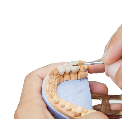 Curso Técnico en Prótesis Dentales