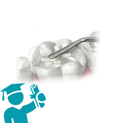 Material Obturación Estudiantes Odontología