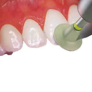 Pastas Pulido Composites